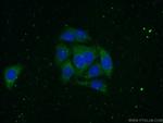 Alpha-2-macroglobulin Antibody in Immunocytochemistry (ICC/IF)