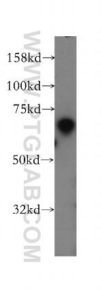 TFEC Antibody in Western Blot (WB)