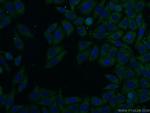 SFI1 Antibody in Immunocytochemistry (ICC/IF)