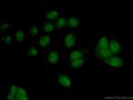 PES1 Antibody in Immunocytochemistry (ICC/IF)