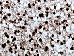 PES1 Antibody in Immunohistochemistry (Paraffin) (IHC (P))
