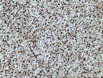 PES1 Antibody in Immunohistochemistry (Paraffin) (IHC (P))