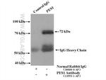 PES1 Antibody in Western Blot (WB)