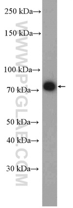 PES1 Antibody in Western Blot (WB)