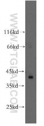 RAD51L1 Antibody in Western Blot (WB)