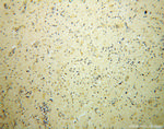 BRUNOL5 Antibody in Immunohistochemistry (Paraffin) (IHC (P))