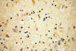 BRUNOL5 Antibody in Immunohistochemistry (Paraffin) (IHC (P))