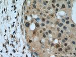 APC2 Antibody in Immunohistochemistry (Paraffin) (IHC (P))