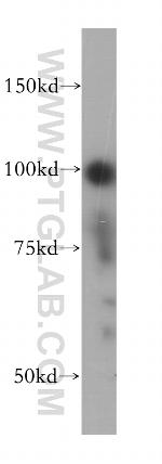 APC2 Antibody in Western Blot (WB)