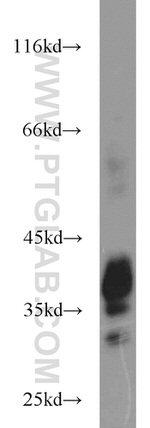 BST2 Antibody in Western Blot (WB)