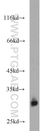 BST2 Antibody in Western Blot (WB)