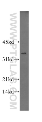 BST2 Antibody in Western Blot (WB)