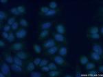 TLK1 Antibody in Immunocytochemistry (ICC/IF)