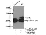 TLK1 Antibody in Immunoprecipitation (IP)