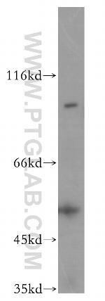 TLK1 Antibody in Western Blot (WB)