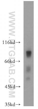 HCFC2 Antibody in Western Blot (WB)