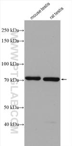 UBQLN3 Antibody in Western Blot (WB)