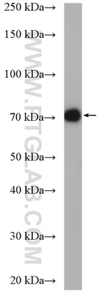 UBQLN3 Antibody in Western Blot (WB)