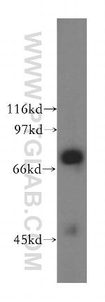 UBQLN3 Antibody in Western Blot (WB)