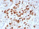 Carboxypeptidase A1/CPA1 (Pancreatic Cancer Marker) Monoclonal Antibody (rCPA1/8518)