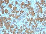 Carboxypeptidase A1/CPA1 (Pancreatic Cancer Marker) Recombinant Rabbit Monoclonal Antibody (CPA1/8259R)