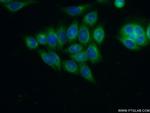 ARFGAP1 Antibody in Immunocytochemistry (ICC/IF)