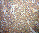 ARFGAP1 Antibody in Immunohistochemistry (Paraffin) (IHC (P))