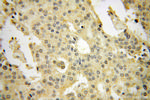 ARFGAP1 Antibody in Immunohistochemistry (Paraffin) (IHC (P))
