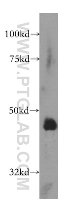 ARFGAP1 Antibody in Western Blot (WB)