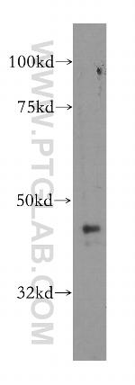 ARFGAP1 Antibody in Western Blot (WB)