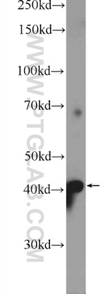 RILP Antibody in Western Blot (WB)