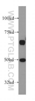STK24 Antibody in Western Blot (WB)