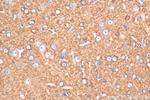 MPP2 Antibody in Immunohistochemistry (Paraffin) (IHC (P))