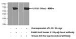 IL1R2 Antibody in Western Blot (WB)