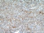 RIOK3 Antibody in Immunohistochemistry (Paraffin) (IHC (P))