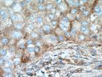 RIOK3 Antibody in Immunohistochemistry (Paraffin) (IHC (P))