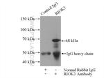 RIOK3 Antibody in Immunoprecipitation (IP)
