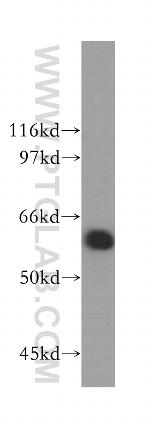 RIOK3 Antibody in Western Blot (WB)