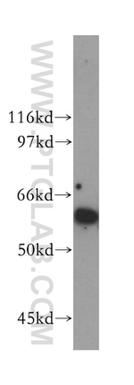 RIOK3 Antibody in Western Blot (WB)