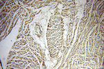 Tenascin-X Antibody in Immunohistochemistry (Paraffin) (IHC (P))