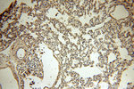 Tenascin-X Antibody in Immunohistochemistry (Paraffin) (IHC (P))