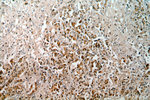 Tenascin-X Antibody in Immunohistochemistry (Paraffin) (IHC (P))