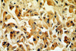Tenascin-X Antibody in Immunohistochemistry (Paraffin) (IHC (P))