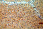 Tenascin-X Antibody in Immunohistochemistry (Paraffin) (IHC (P))