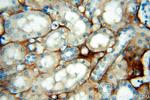 Tenascin-X Antibody in Immunohistochemistry (Paraffin) (IHC (P))
