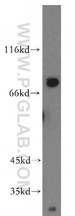 Tenascin-X Antibody in Western Blot (WB)