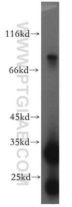 Tenascin-X Antibody in Western Blot (WB)