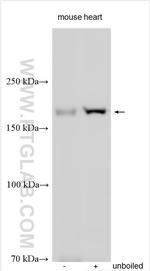 SUR2/ABCC9 Antibody in Western Blot (WB)