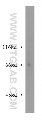 LSAMP Antibody in Western Blot (WB)