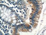 ITM2C Antibody in Immunohistochemistry (Paraffin) (IHC (P))
